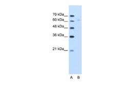 Pyruvate Dehydrogenase E2 Antibody, Novus Biologicals 0.1mg; Unlabeled:Antibodies,